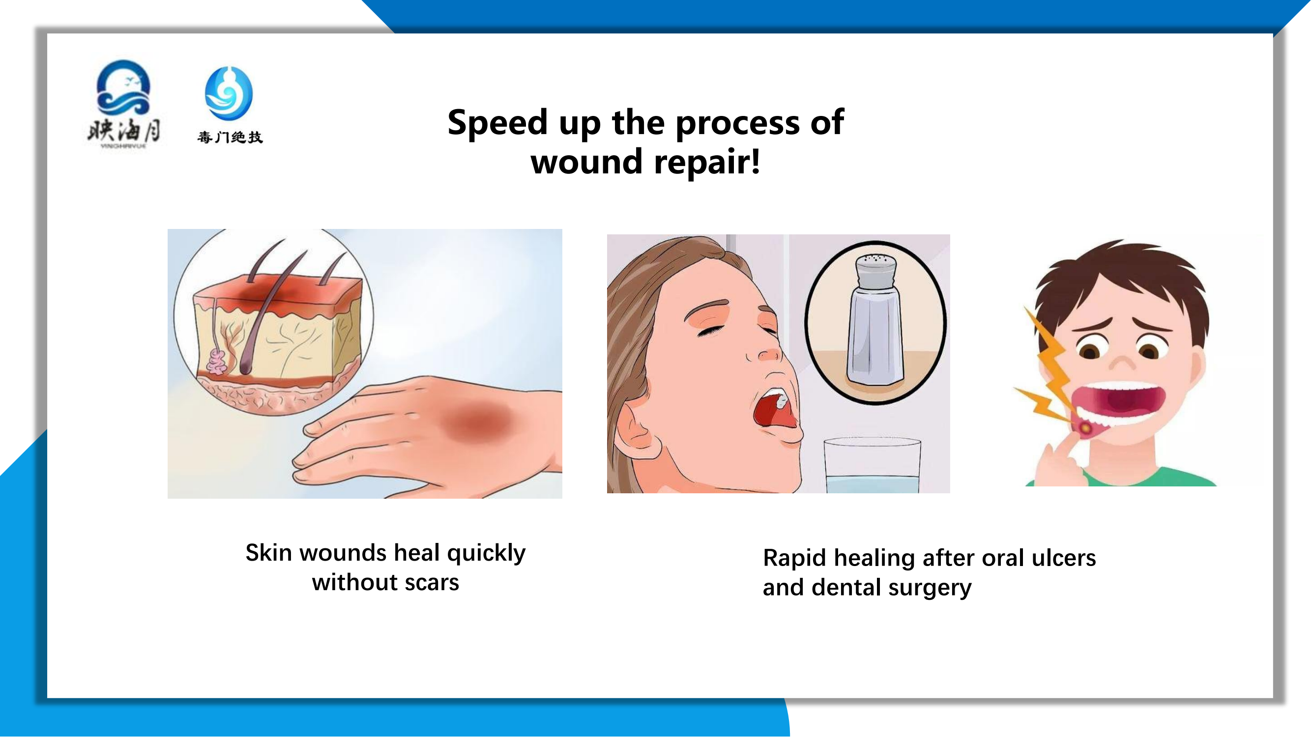 CBF-14口喷液英文_10