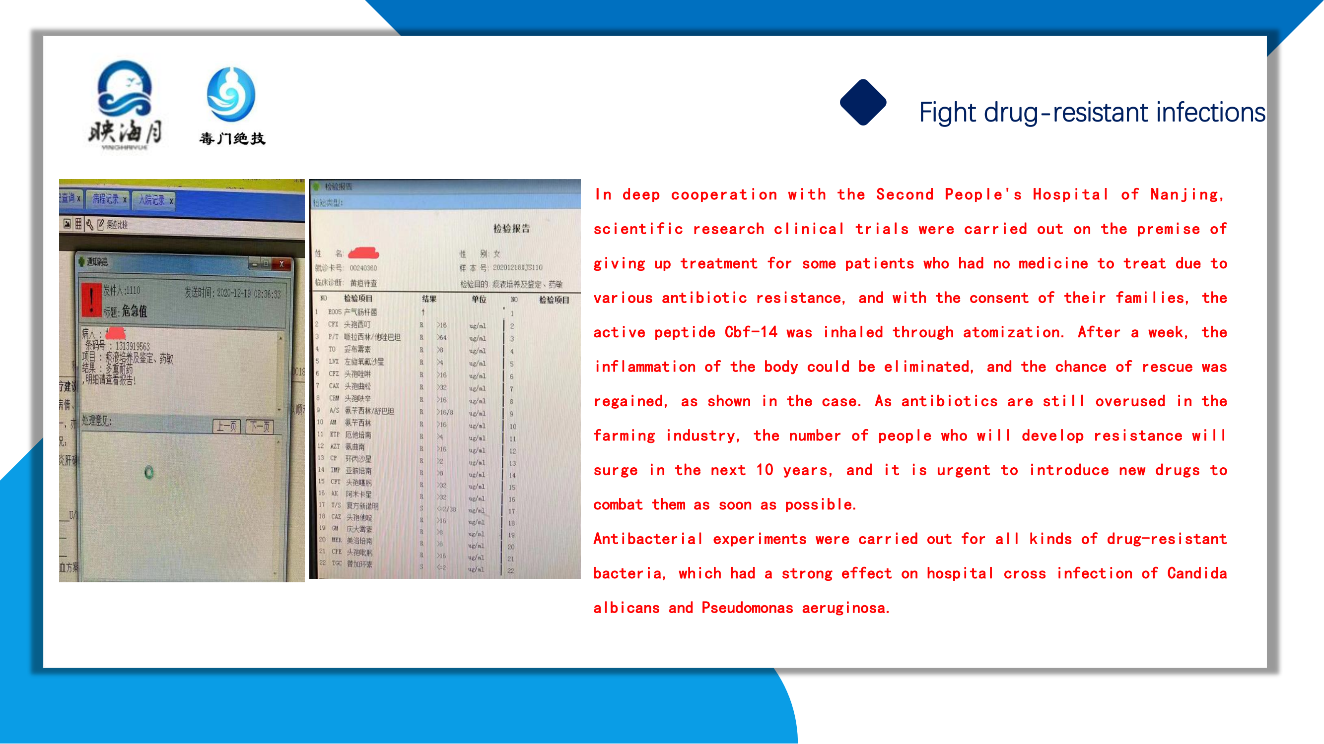 CBF-14口喷液英文_05